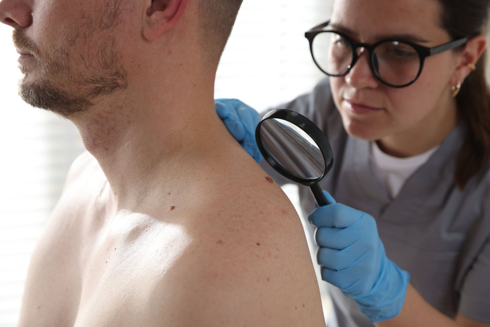 Лечение меланомы: от диагноза до плана терапии